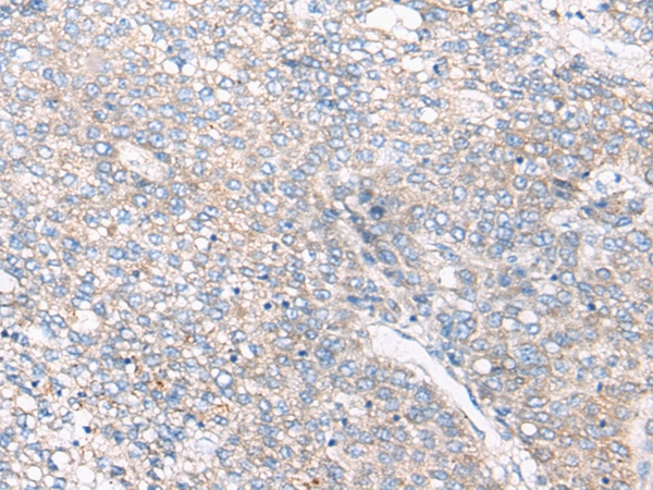 C3/C3b Antibody