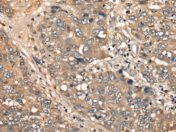 CD276 Antibody