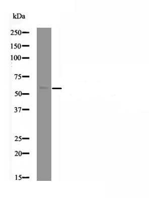 PINK1 (Phospho- Thr313) Antibody