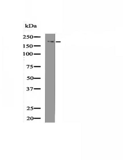 DNMT1 (Phospho-Ser958) Antibody