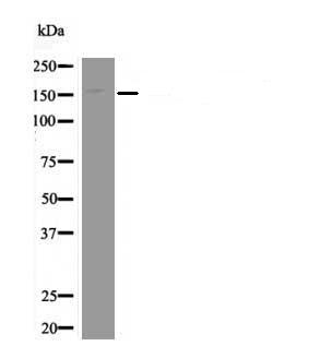 EPRS (Phospho-Ser999) Antibody