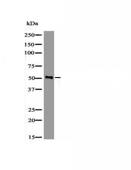 MEF2C (Phospho-Ser98) Antibody