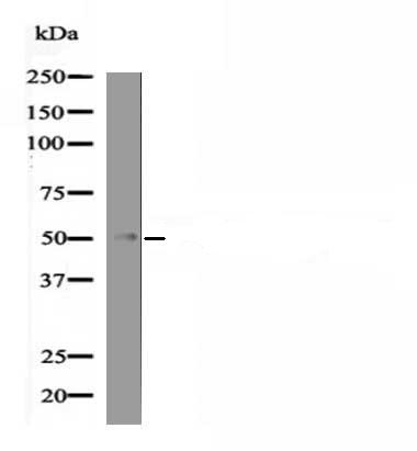 MEF2C (Phospho-Ser222) Antibody