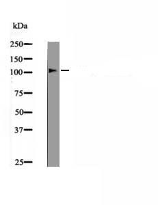 LLGL2 (Phospho-Tyr499) Antibody