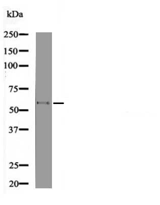 PKM2(Phospho-Ser37) Antibody