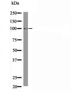 Ezh2 (Phospho-Thr487) Antibody