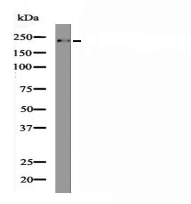 NMIIA (Phospho-Ser1916) Antibody