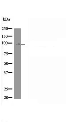 FoxO3a (Phospho-Ser574) Antibody