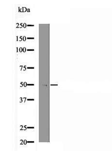 Rpt6 (Phospho-Ser120) Antibody