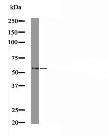 MST1 (Phospho-Tyr433) Antibody