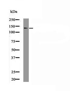 EPHA2 (Phospho-Ser901) Antibody