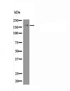 perk (Phospho-Ser1094) Antibody