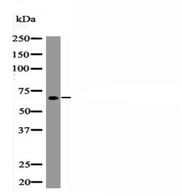 RUNX2 (Phospho-Ser340) Antibody