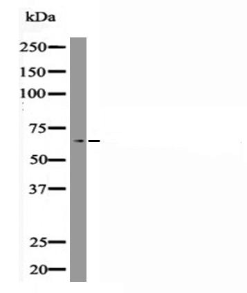 RUNX2 (Phospho-Ser28) Antibody