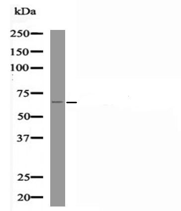 RUNX2 (Phospho-Ser451) Antibody