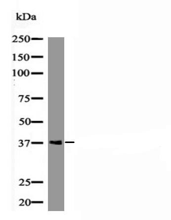 RAD51 (Phospho-Tyr54) Antibody