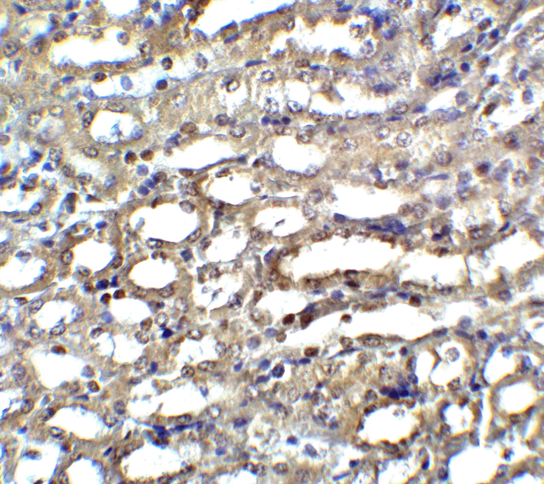 ICAD Antibody