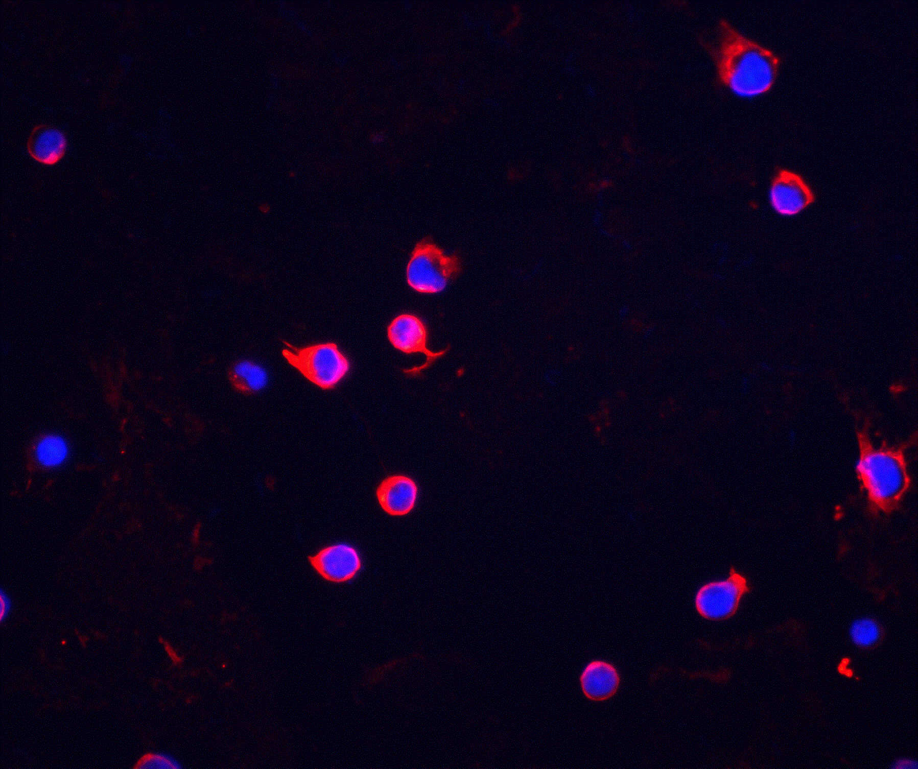 Chk2 Antibody