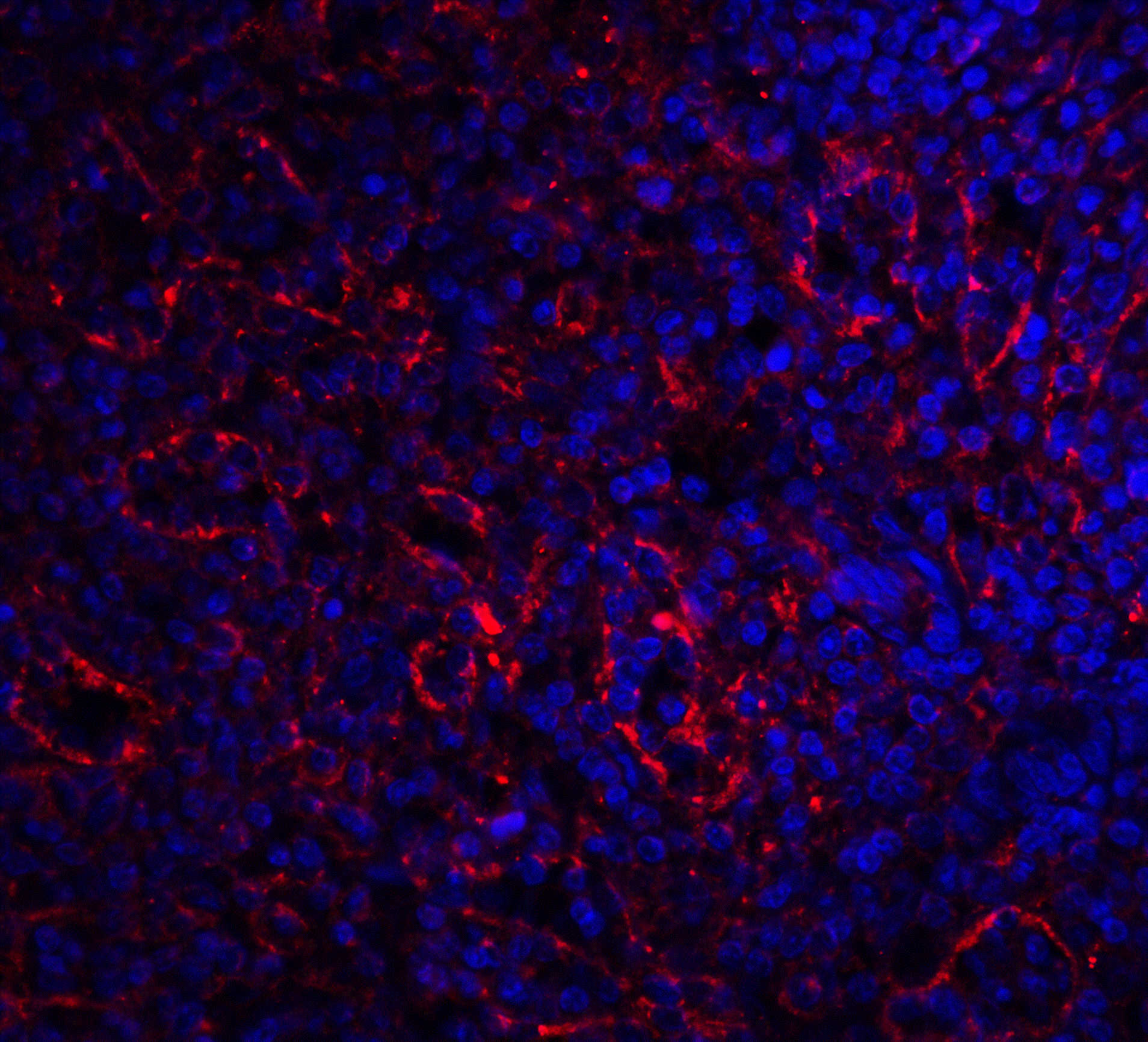 BAFF Receptor Antibody