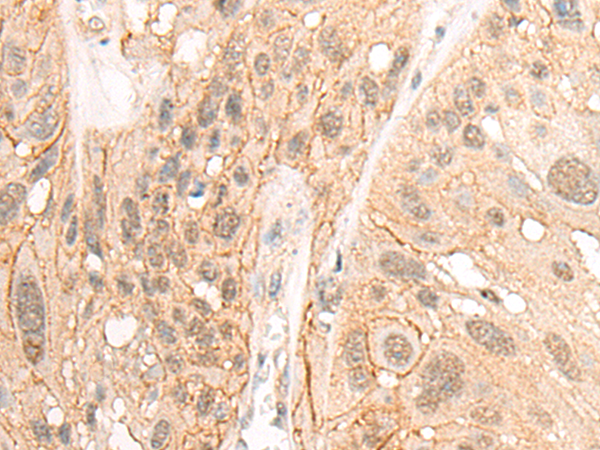 HOXA10 Antibody