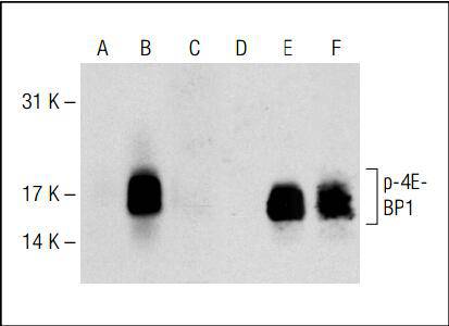 4E-BP1/2/3 (Phospho-Thr 45) Antibody