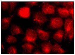 PKA C (Phospho-Thr198) Antibody