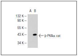 PKA C (Phospho-Thr198) Antibody