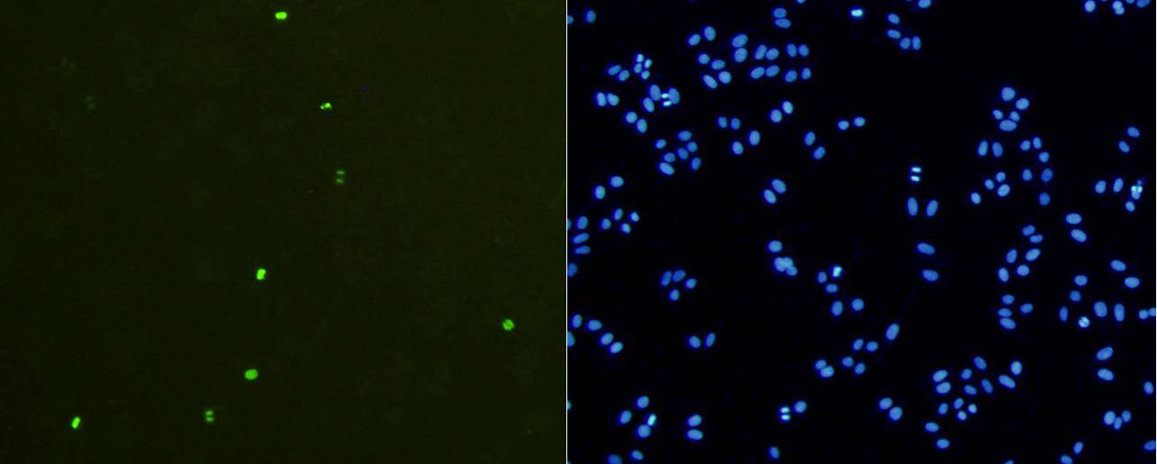 Phospho-Histone H3(S10) Rabbit mAb