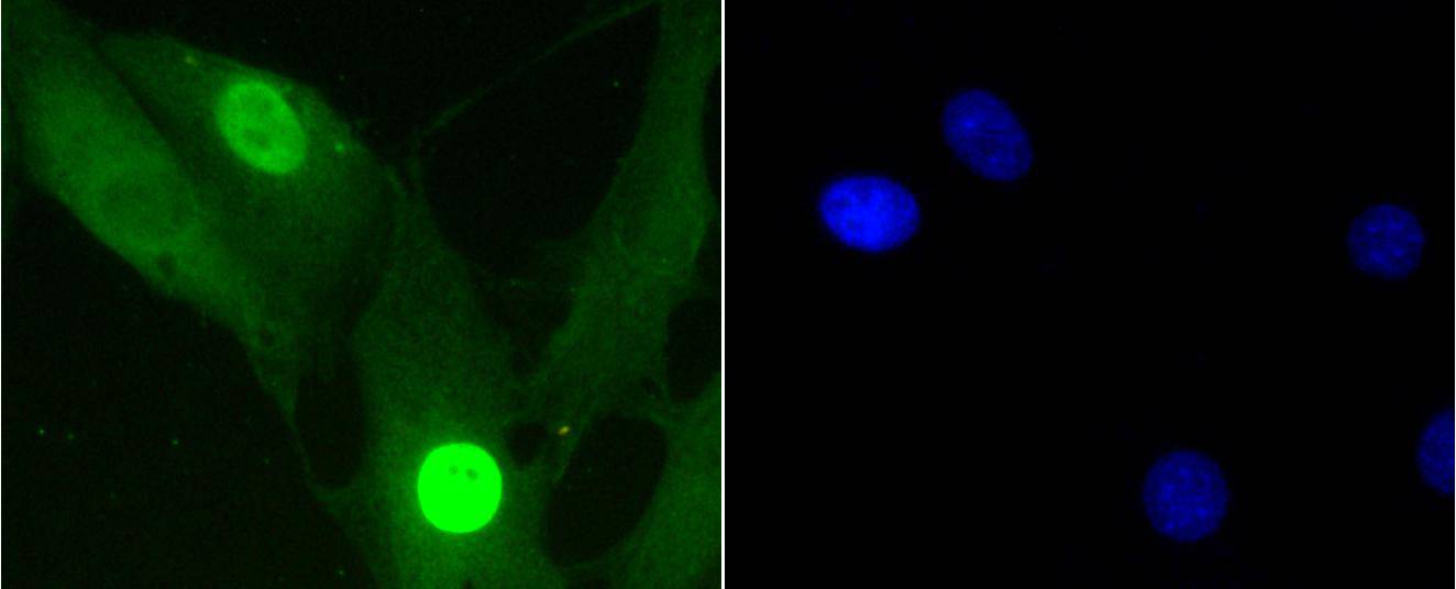 Phospho-Histone H1.3(T17)+Histone H1.4(T17) Rabbit mAb