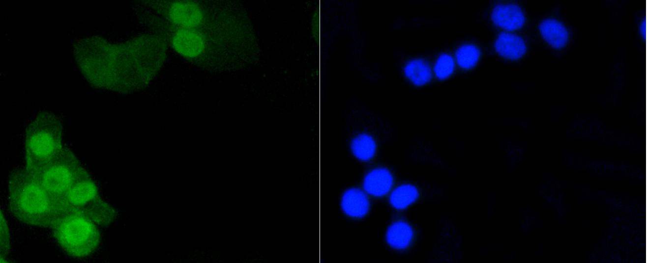 Phospho-Histone H1.3(T17)+Histone H1.4(T17) Rabbit mAb