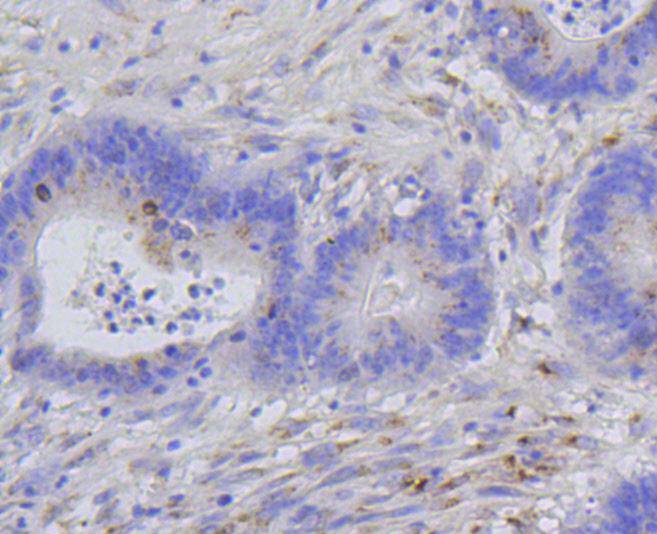 Phospho-Histone H1.3(T17)+Histone H1.4(T17) Rabbit mAb