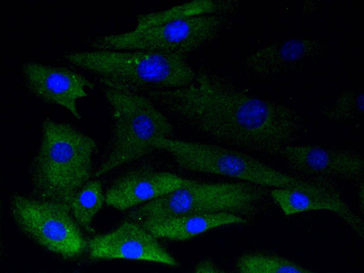 Phospho-Glycogen synthase 1(S641) Rabbit mAb