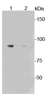 Phospho-Glycogen synthase 1(S641) Rabbit mAb