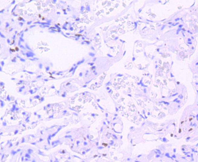 Phospho-STAT3(Tyr705) Rabbit mAb