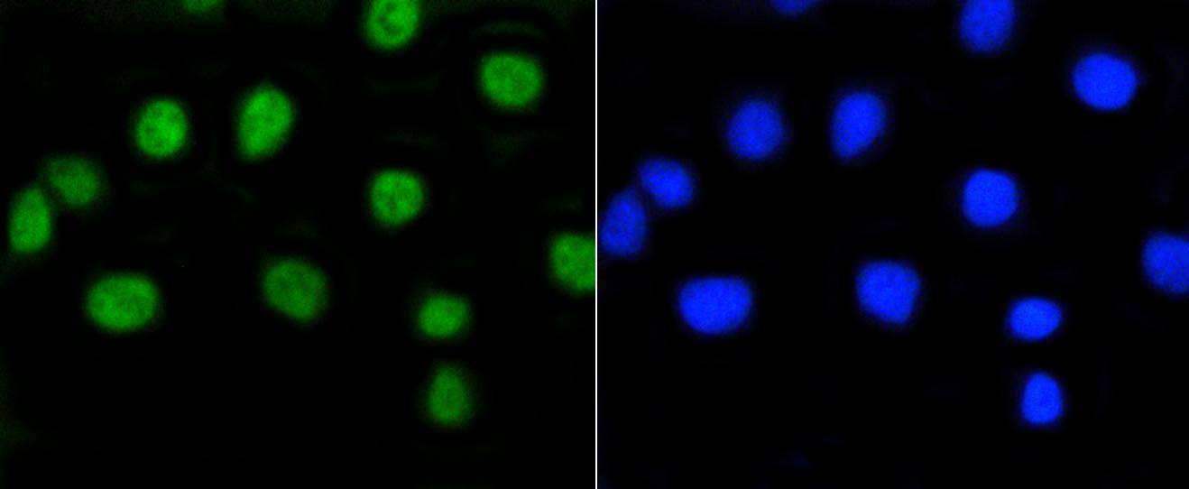 Phospho-Rb(S807) Rabbit mAb