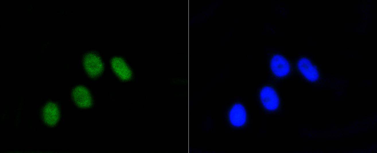 Phospho-Rb(S807) Rabbit mAb