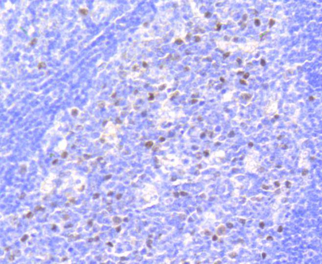 Phospho-Rb(S807) Rabbit mAb