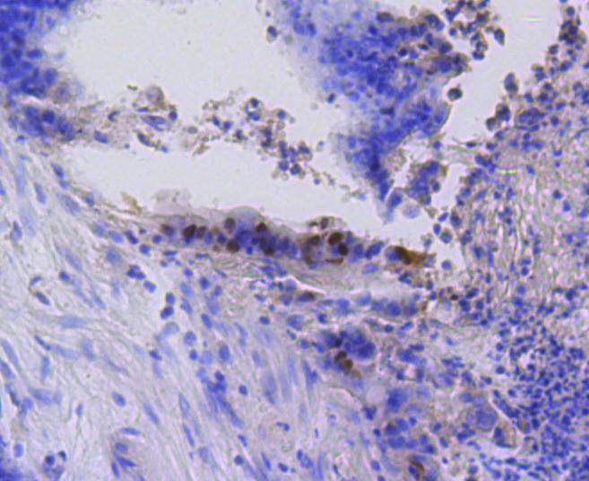 Phospho-Rb(S807) Rabbit mAb