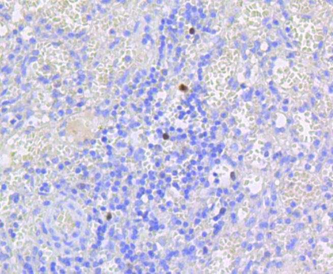 Phospho-Rb(S807) Rabbit mAb