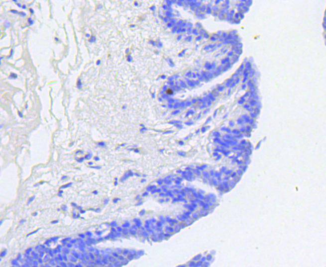 Phospho-Rb(S807) Rabbit mAb