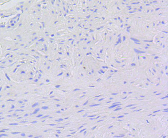 P-V-Myb+C-Myb(S11) Rabbit mAb