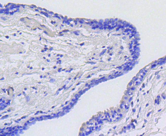 P-V-Myb+C-Myb(S11) Rabbit mAb