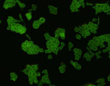 β-Catenin Antibody