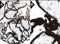 Angiopoietin-2 Antibody