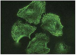 Iba1 Antibody