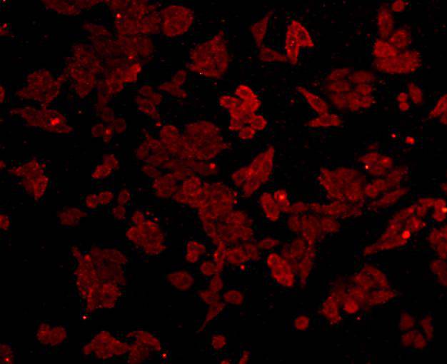 Sequestosome-1 Antibody