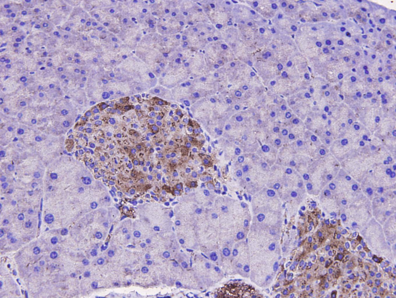 Sequestosome-1 Antibody