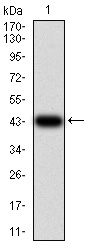 IL1RAPL1 Antibody