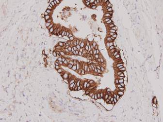 HER2 / ErbB2 Antibody