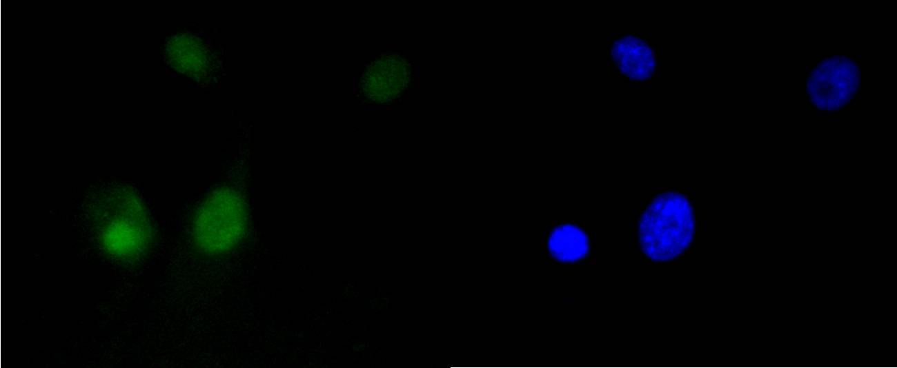 HMGB1 Rabbit mAb